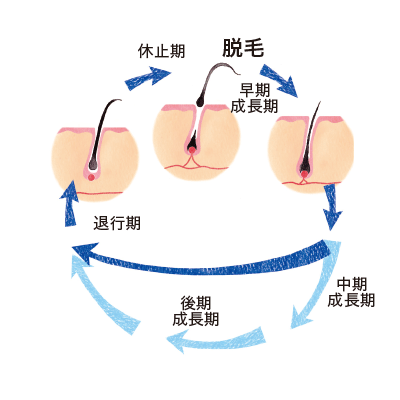 乱れたヘアサイクル