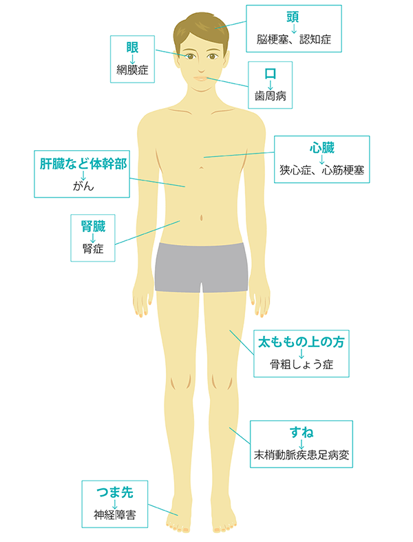 図：全身に広がる合併症のリスク