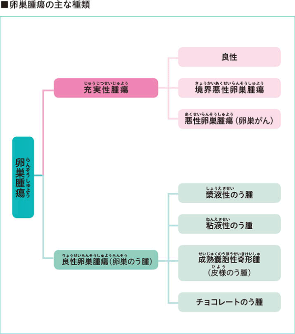 図：卵巣腫瘍の主な種類