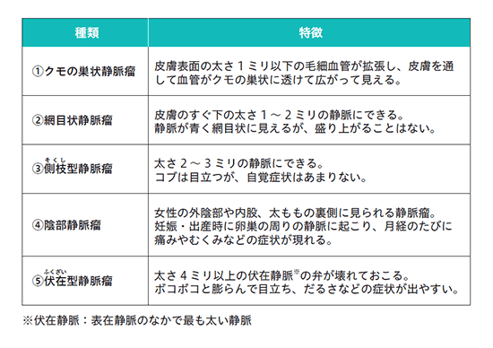 下肢静脈瘤の種類と特徴