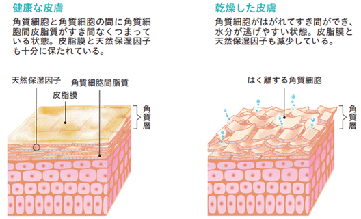 ■健康な皮膚と乾燥した皮膚