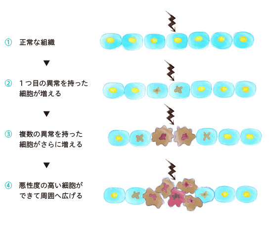 がんが発症するメカニズム