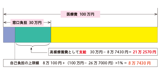 69歳以下で年収が約370万～約770万円の場合、医療費が100万円で、窓口負担（3割）が30万円かかる際には、実際の自己負担額は上限の8万7430円となり、差額分の21万2570円は高額療養費として支給