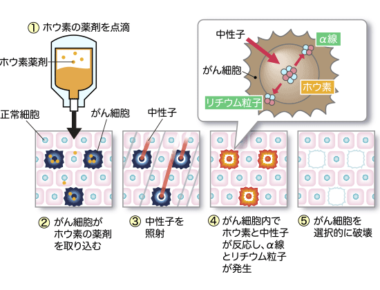 BNCTの仕組み