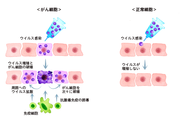 ウイルス療法の概念