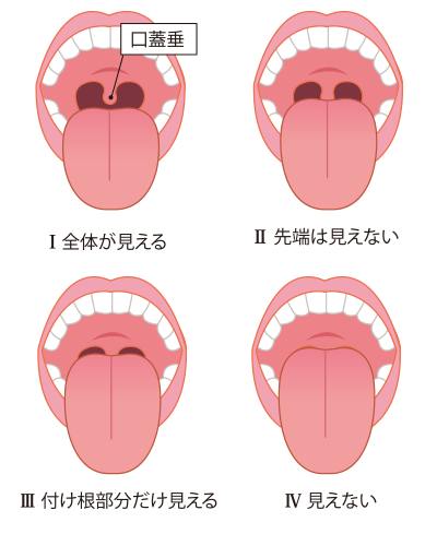 図1　気道をチェックしよう