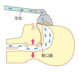 写真：CPAPの使い方