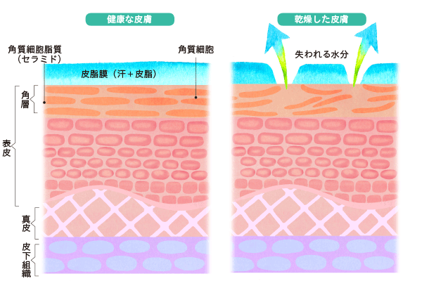 健康な皮膚と乾燥した皮膚の構造